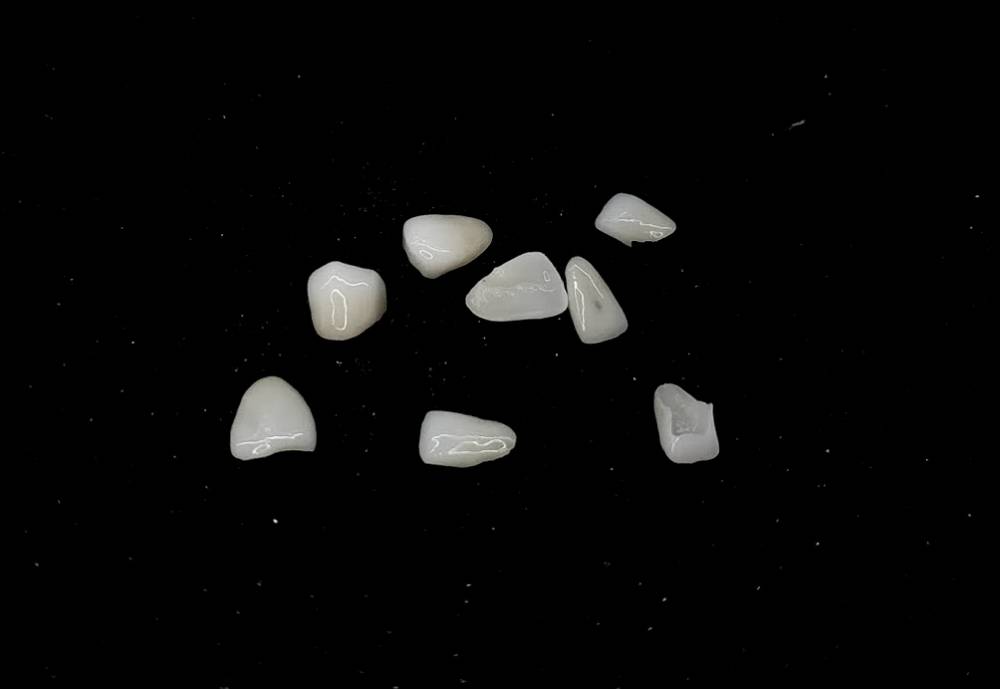 Izgled keramickih faseta (vinira) na tamnoj pozadini 