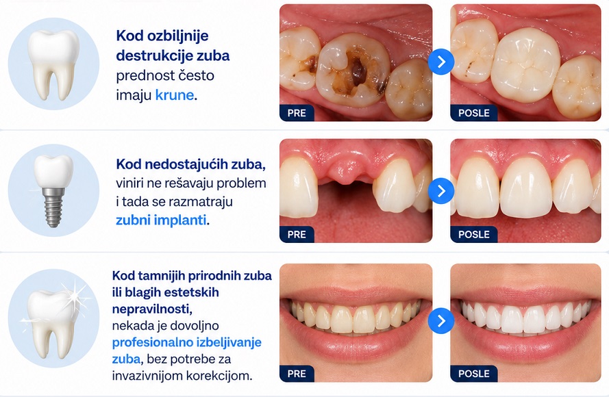 Predlozene i druge opcije