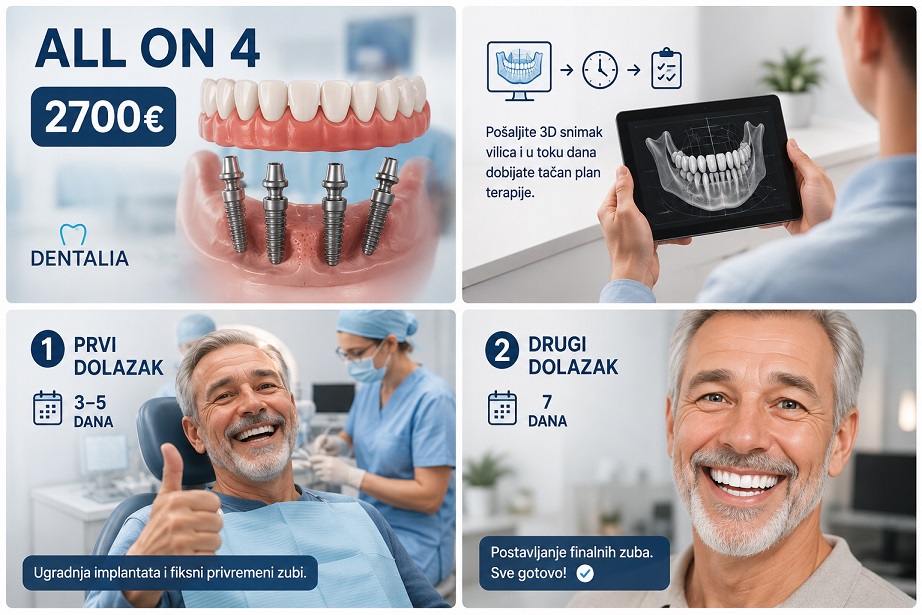 Prikaz cene i faza izrade all on 4 procedure u par koraka
