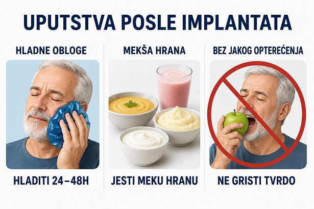 Upustva posle ugradnje implantata