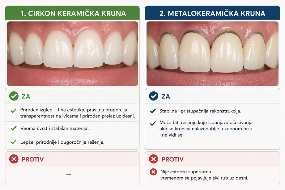 poredak prednosti i mana cirkon ili metalokeramicke krune